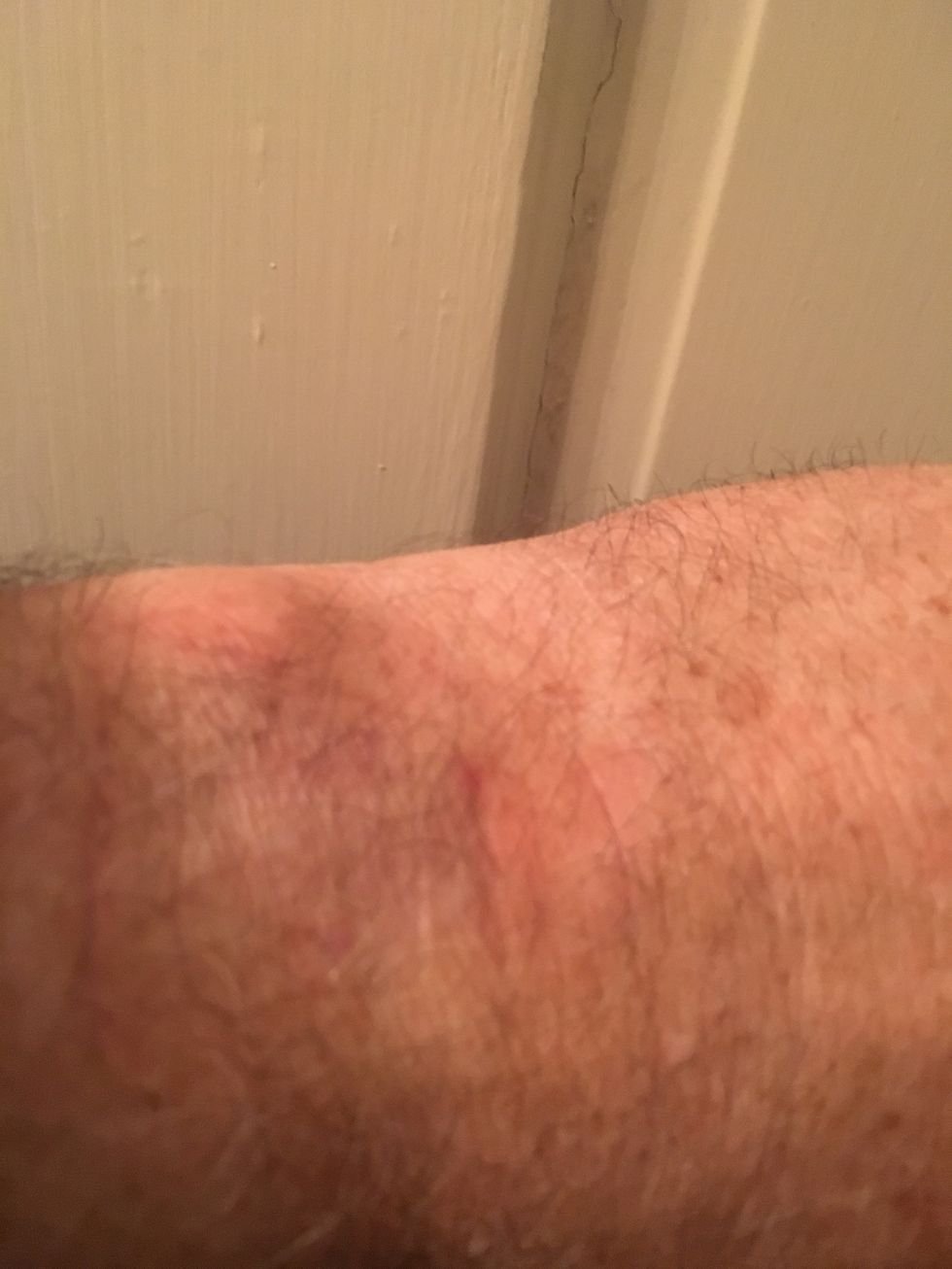 a photo of a man's arm