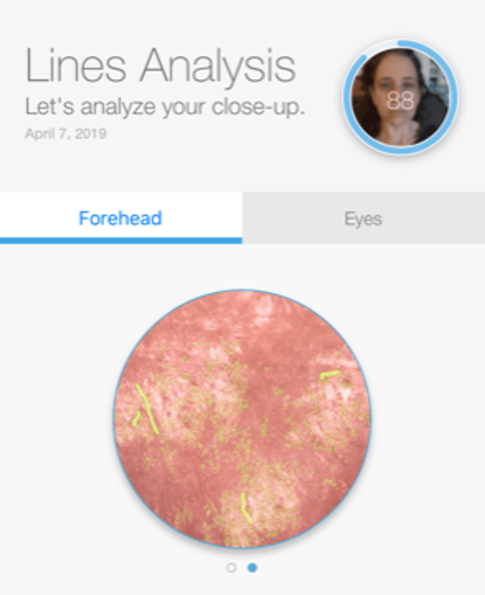 A photo of the closeups of lines the Neutrogena Skin Scanner picked up on my forehead