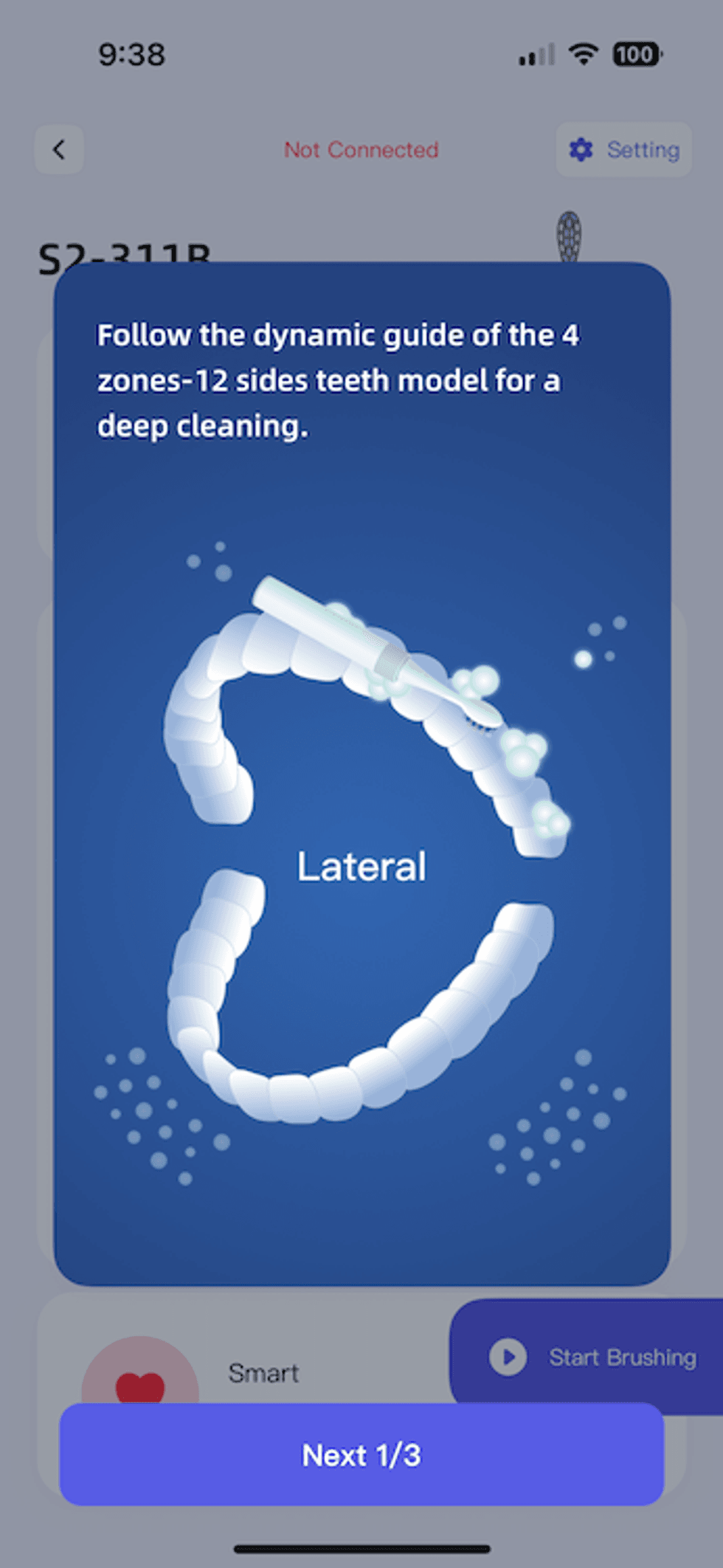a screenshot of the dynamic guide for brushing your teeth with Bitvae S2 Smart Electric Toothbrush