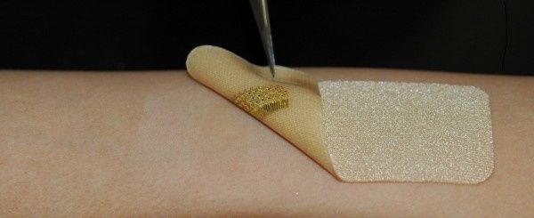 sensor wound healing skin