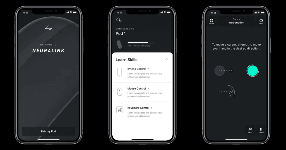 Images of a Neuralink iPhone app