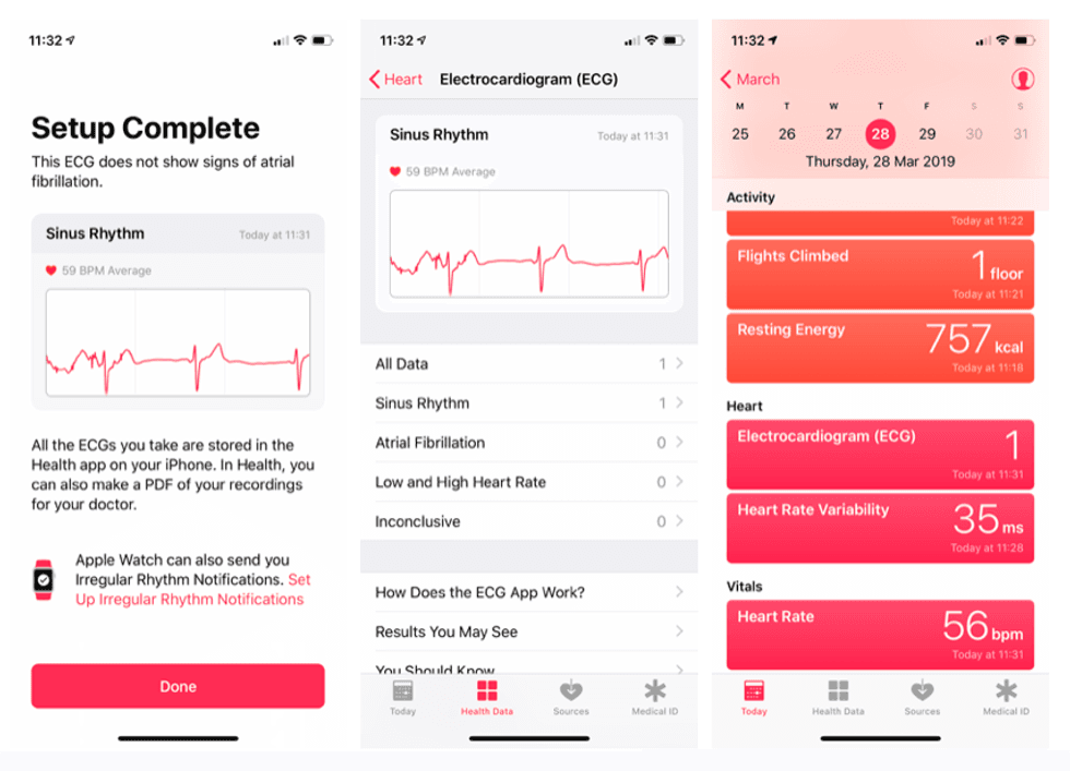Screenshots of the Apple Watch's ECG feature from the iOS Health app