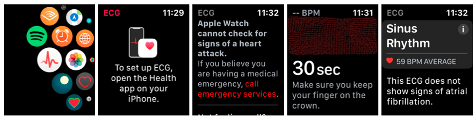 Screenshots of the ECG app of the Apple Watch Series 4