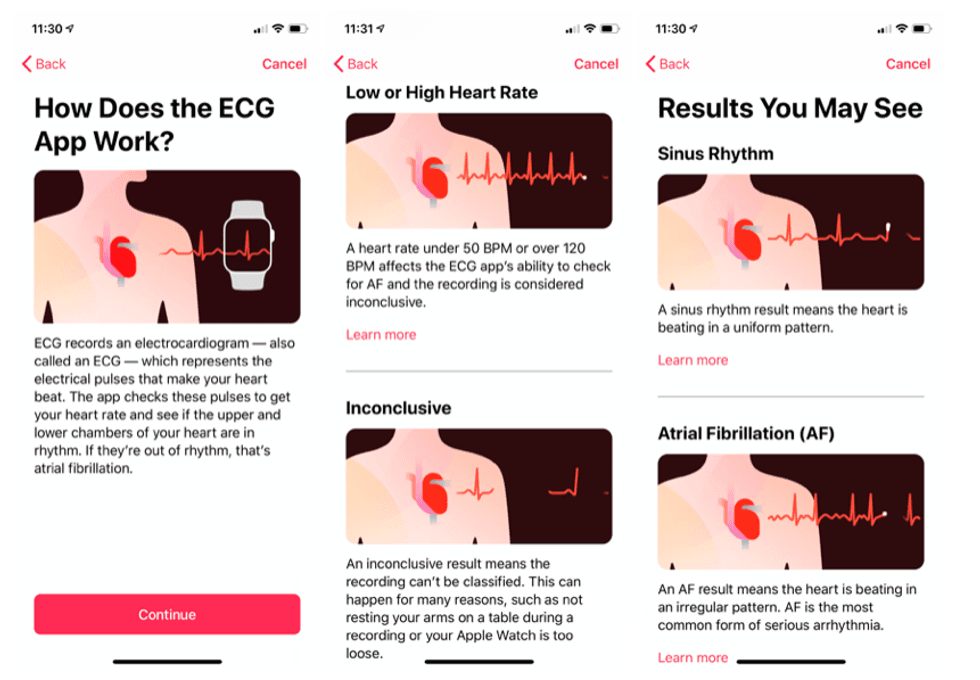 Screenshots of the ECG feature of the Apple Watch Series 4