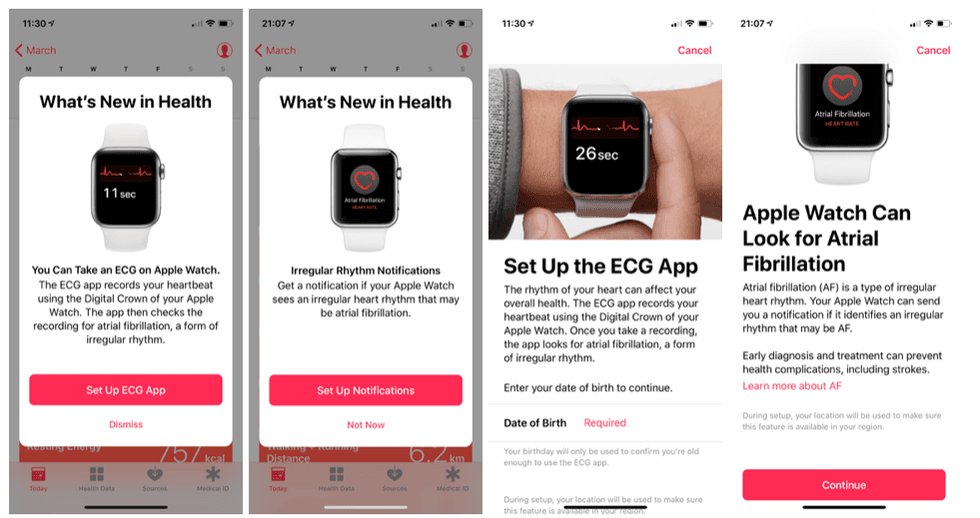 Screenshots of the iOS Health app setting up ECG on the Apple Watch Series 4